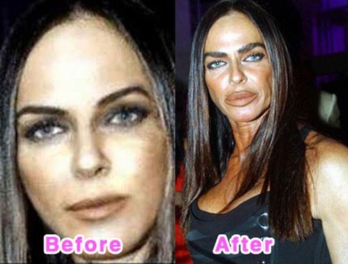 failure-Celebrity-Plastic-Surgery-Before-and-After
